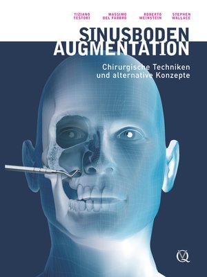 cover image of Sinusbodenaugmentation
